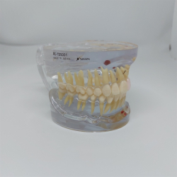 Transparent Sygdomsmodel